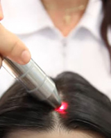 Лазерная терапия волос